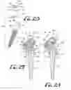 Fig. 07 - Dental attachment assembly and method