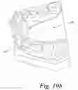 Fig. 22 - Methods for placing an implant analog in a physical model of the patient's mouth