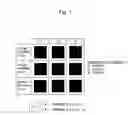 Fig. 02 - Kits and method for determining the risk of adverse effects of irinotecan comprising hybridizing pairs of nucleic acid probes