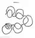 Fig. 04 - Compositions and methods for diagnosing patients with acute atherosclerotic syndrome