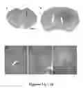 Fig. 02 - In vivo amplification of neural progenitor cells