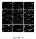 Fig. 04 - In vivo amplification of neural progenitor cells