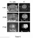 Fig. 09 - In vivo amplification of neural progenitor cells
