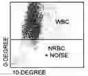Fig. 01 - Method for determination of nucleated red blood cells and leukocytes in a whole blood sample in an automated hematology analyzer