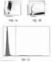 Fig. 02 - Method for determination of nucleated red blood cells and leukocytes in a whole blood sample in an automated hematology analyzer