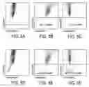 Fig. 06 - Method for determination of nucleated red blood cells and leukocytes in a whole blood sample in an automated hematology analyzer