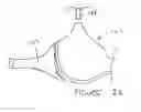 Fig. 03 - PARTIAL CORE PAD INCORPORATING BRASSIERE