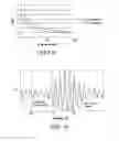 Fig. 05 - Single sideband voice signal tuning method