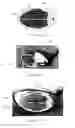 Fig. 02 - SPORTS IMPACT POINT INDICATOR