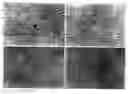 Fig. 01 - Phenotypic reversion of pancreatic carcinoma cells