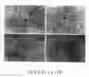 Fig. 02 - Phenotypic reversion of pancreatic carcinoma cells