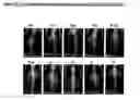 Fig. 63 - Gastric Retention and Controlled Release Delivery System
