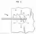 Fig. 04 - Implantable radiotherapy/Brachytherapy Radiation Detecting Apparatus and Method