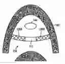 Fig. 01 - Bioabsorbable casing for surgical sling assembly
