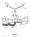 Fig. 02 - Electrode array