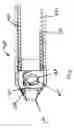 Fig. 06 - Bone marrow biopsy needle