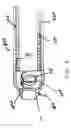 Fig. 07 - Bone marrow biopsy needle