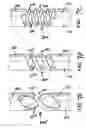 Fig. 08 - Bone marrow biopsy needle