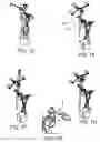 Fig. 09 - Navigated application guide for targeted spinal drug delivery