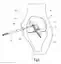 Fig. 07 - Device for guiding a drilling tool for forming a second bore in a bone