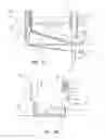 Fig. 49 - Systems and Methods for Treating Septal Defects with Capture Devices and Other Devices