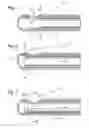 Fig. 02 - Method of operating a microsurgical instrument