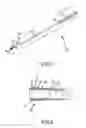 Fig. 02 - Retractable separating systems and methods