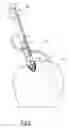 Fig. 07 - Device for introducing an anchor element into a bone