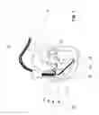 Fig. 02 - IMPLANTABLE MEDICAL DEVICE