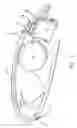 Fig. 06 - Visual prosthetic apparatus for retinal stimulation