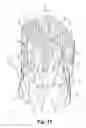 Fig. 09 - PERCUTANEOUS HEART VALVE DEVICES