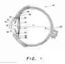 Fig. 02 - Multi-element accommodative intraocular lens