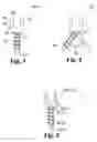 Fig. 03 - Methods for positioning a load-bearing component of an orthopedic implant device by inserting a malleable device that hardens in vivo