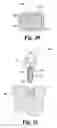 Fig. 09 - Methods for positioning a load-bearing component of an orthopedic implant device by inserting a malleable device that hardens in vivo