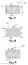 Fig. 12 - Methods for positioning a load-bearing component of an orthopedic implant device by inserting a malleable device that hardens in vivo