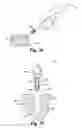 Fig. 16 - Methods for positioning a load-bearing component of an orthopedic implant device by inserting a malleable device that hardens in vivo