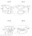 Fig. 06 - Methods and devices for correcting spinal deformities
