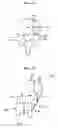 Fig. 07 - Methods and devices for correcting spinal deformities