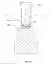 Fig. 48 - Articulating diamond-surfaced spinal implants