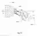 Fig. 53 - Articulating diamond-surfaced spinal implants