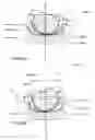 Fig. 71 - Articulating diamond-surfaced spinal implants