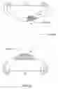 Fig. 77 - Articulating diamond-surfaced spinal implants