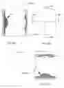 Fig. 86 - Articulating diamond-surfaced spinal implants
