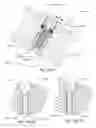 Fig. 95 - Articulating diamond-surfaced spinal implants