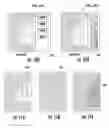 Fig. 07 - Dynamic slabbing to render views of medical image data