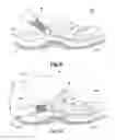 Fig. 06 - Footwear with retainable strap