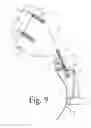 Fig. 10 - Snowplow system, snow deflector apparatus and kit