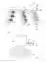 Fig. 02 - Irrigation kit and method for use thereof