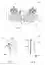 Fig. 04 - Irrigation kit and method for use thereof