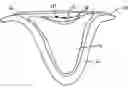 Fig. 01 - Soil-less seed support medium and method for germinating a seed
